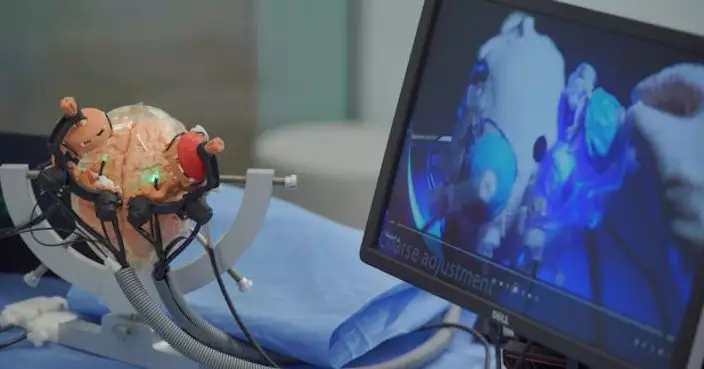 港大機械工程系團隊改良技術 提升立體定位神經外科手術精確度