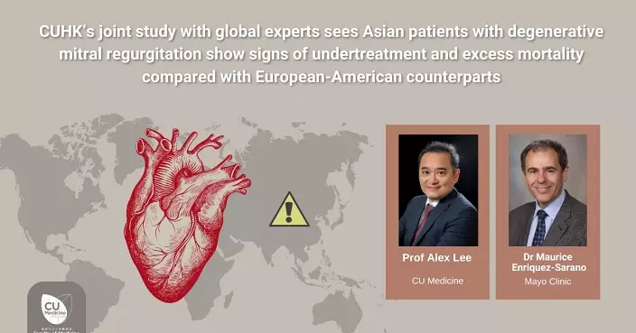 中大與國際心臟專家團隊發現亞洲退化性二尖瓣倒流患者 死亡率較預期高