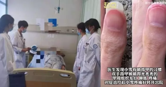 浙江14歲女常咬手引關節炎敗血症！醫警告：長期嚴重危害健康