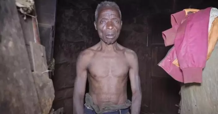 疑因心理障礙！非洲71歲翁保持處男身 55年來與女性「零接觸」