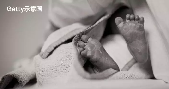 唔理產婦要求開刀 美醫生用真空吸引器吸15次「硬拉出」致男嬰死亡