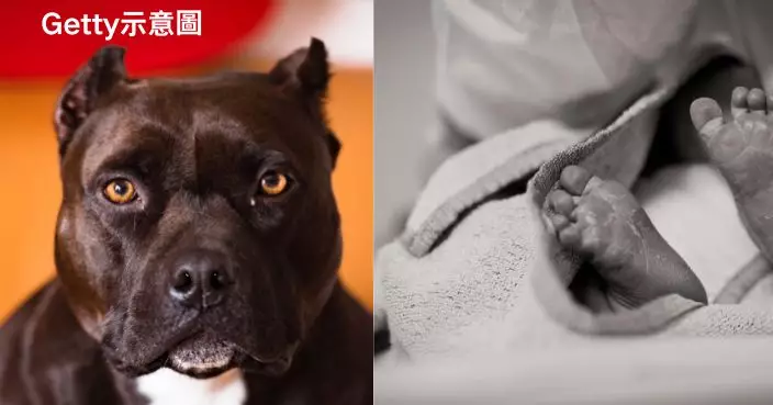被外出爸媽放梳化瞓覺 巴西5個月大女B遭養5年寵物犬狂咬身亡
