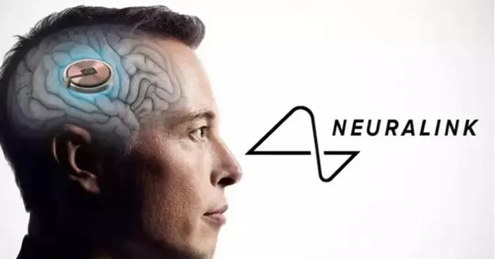 首例大腦植入晶片患者  馬斯克旗下Neuralink：體內線路已穩定