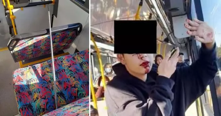 中國留學生奧克蘭巴士上遭鋼棒打甩牙 總領館促盡快緝兇