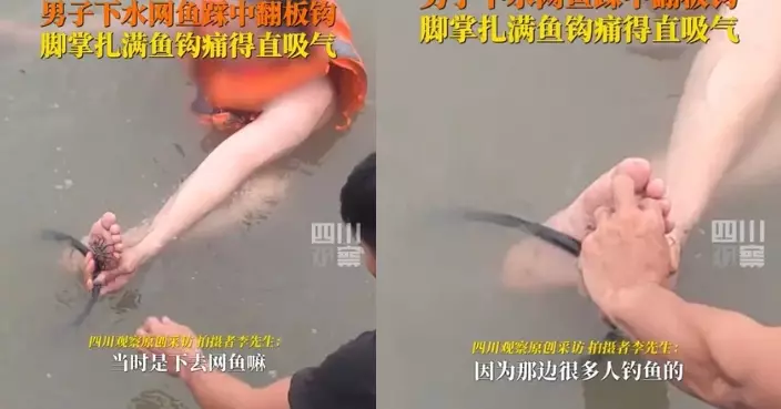 下水捕魚誤踩「八爪鉤」廣州男腳掌插滿魚鉤痛到狂吸氣