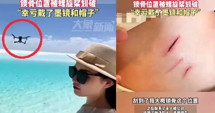 女遊客青海湖邊影相遭無人機撞面 臉紅腫鎖骨被劃傷 幸戴墨鏡免毀容