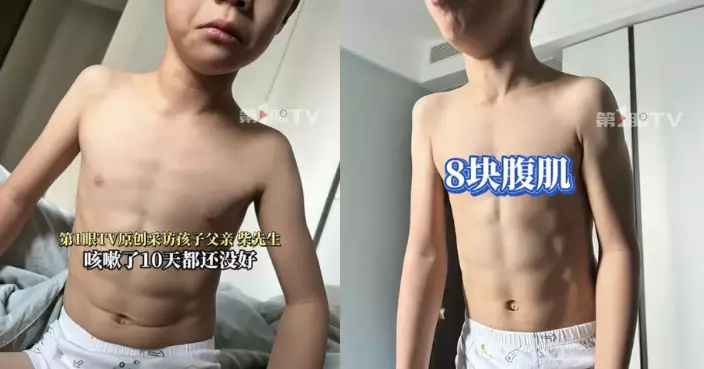 持續咳嗽10日 西安7歲男童咳出「8嚿腹肌」 網民：一天咳多少組？