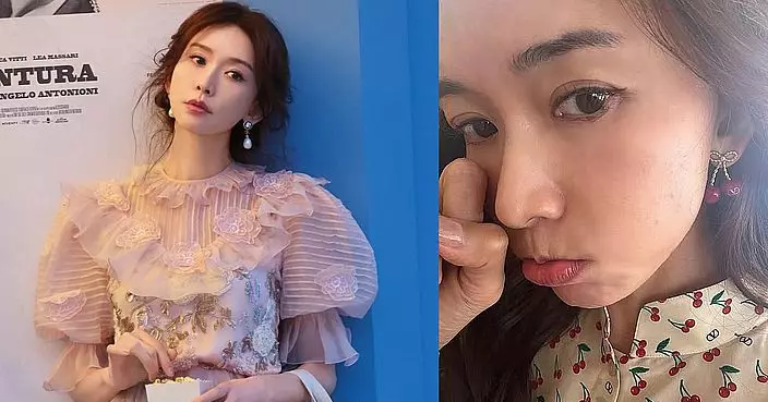 林志玲康城影展前臉部突發過敏 甜美造型獲網友力挺還是最美