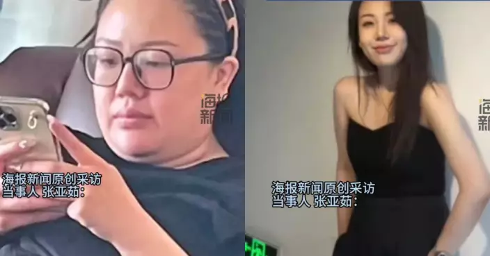 長期肥胖感自卑 山東90KG肥女1年狂甩32.5KG直呼：周圍人眼光友善了