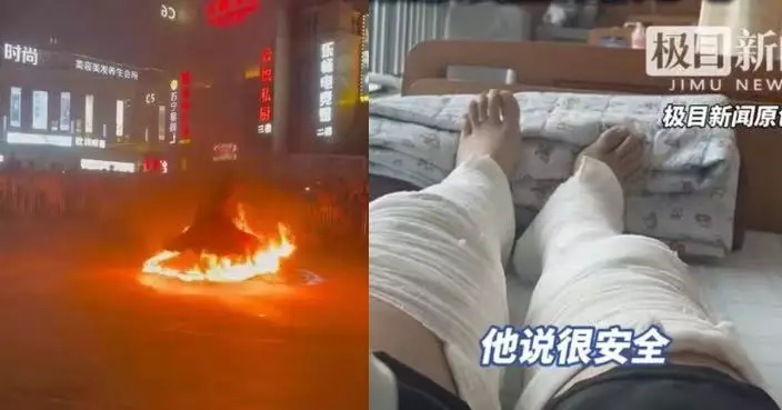 受邀表演「火裙舞」火苗竄燒 浙女舞者腿臀三度燒傷 控主辦防護不足