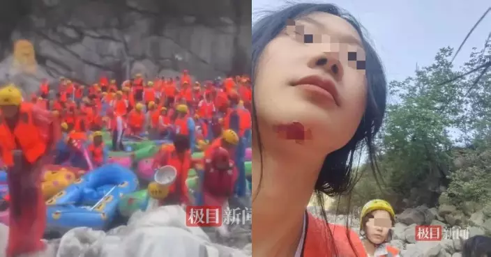 陝西體驗漂流船發生側翻 女遊客下巴縫數針險遭石頭割喉