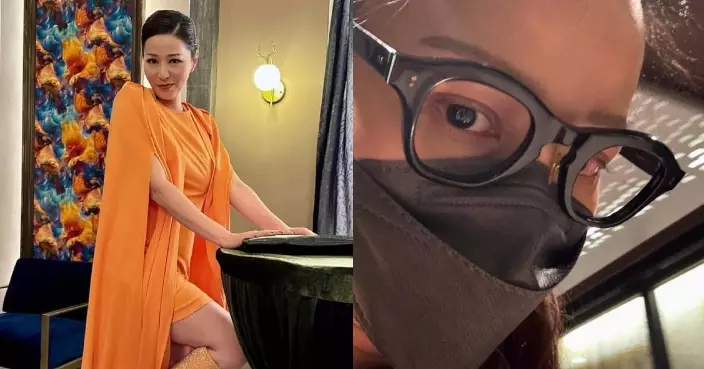 滕麗名自爆視網膜脫落 幸及早治療有驚無險