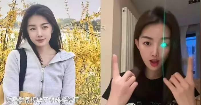 因車禍失右眼 北京舞蹈老師變設計師製特色義眼助逾300單眼人士重拾自信