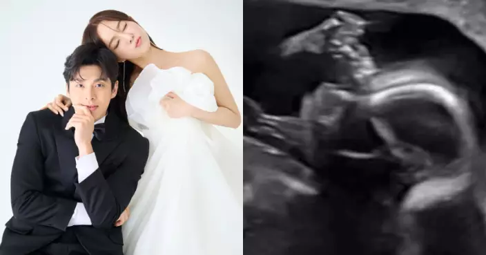韓44歲女歌手嫁小6歲老公兩年宣布造人成功 分享超聲波照報喜