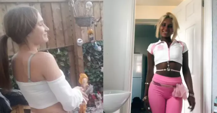 美黑成癮！英女照燈打針黑到似「燒燶薯片」 疑皮膚病變仍難自拔