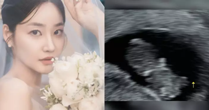 前AOA酉奈結婚一年半再報喜 晒超聲波照宣布懷孕