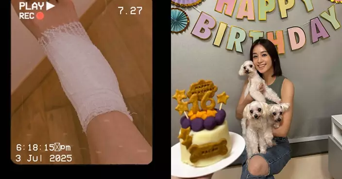 黃心美為愛犬慶生意外拗柴 忍痛接受跌打治療