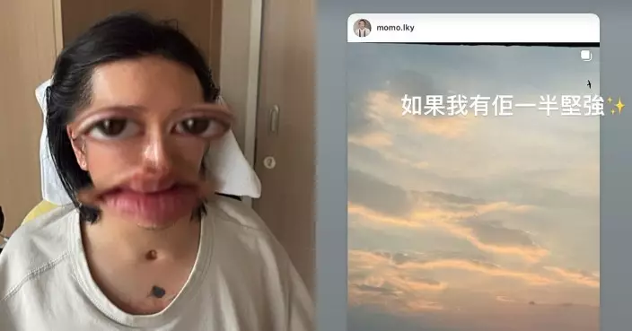 阿Mo首晒自拍露出「呼吸道造口」SoChing心疼：如果我有佢一半堅強