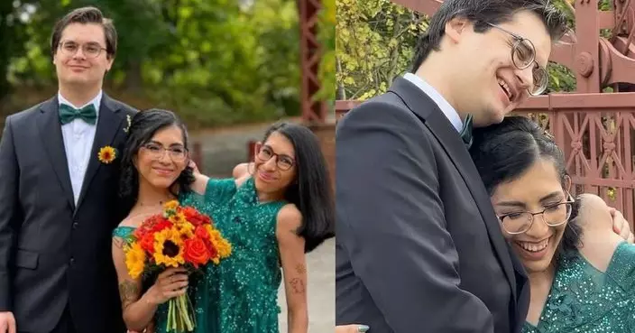 存活超預期 美連體姊妹共享骨盆及生殖系統 姐步入婚姻妹維持單身