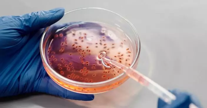 超級細菌危機爆發！研究揭2050年恐奪千萬命 全球GDP蒸發1.7萬億美元