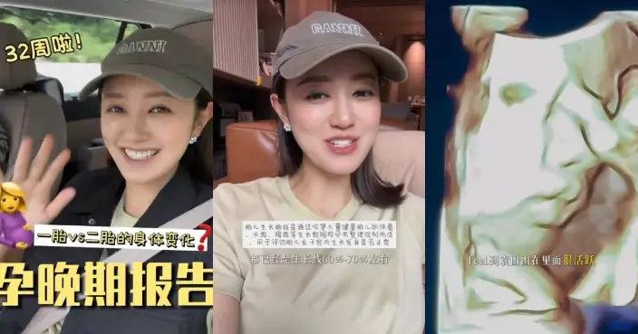 張寶兒分享進入懷孕晚期狀態 第二胎「袁凼凼」大得快又好活躍