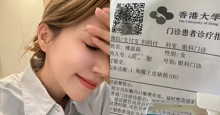 傅嘉莉換衫意外割損眼角膜 急求醫幸未影響拍劇