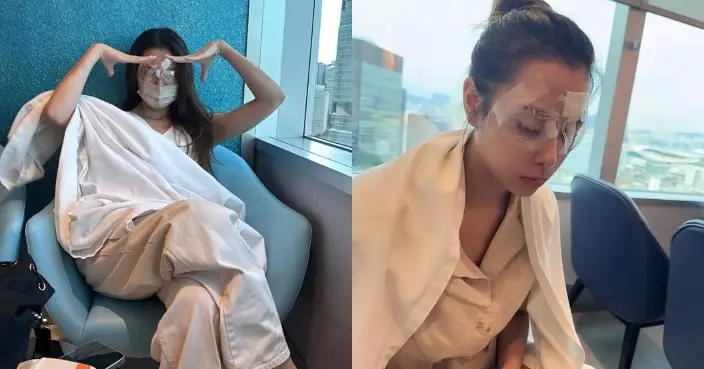 「東張女神」俞可程激光矯視驚現罕見意外 眼角膜瓣移位急重鋪