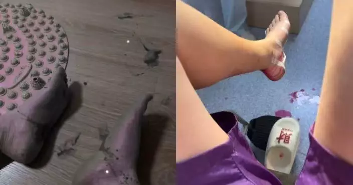 網掀「指壓板超慢跑」熱潮 上海女跟風練習腳底突噴血送院 醫生警告：勿亂試