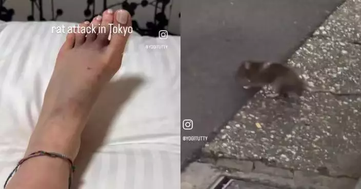 東京爆「鼠患危機」 杜拜女遊客新宿街頭遭咬傷腳背血流滿地