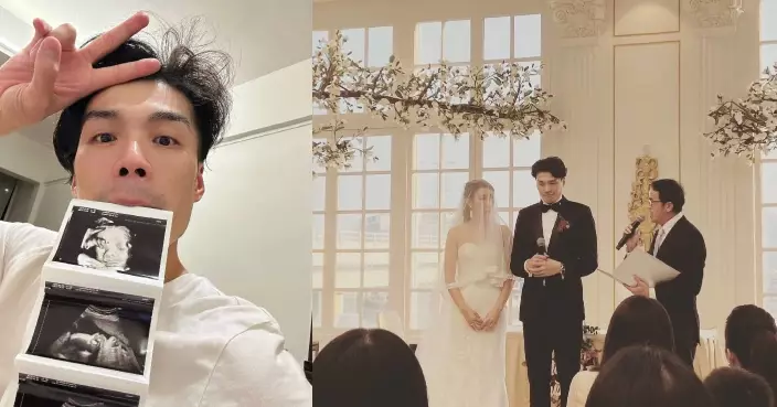 劍擊運動員張小倫宣布榮升爸爸 晒超聲波照透露正為BB改名