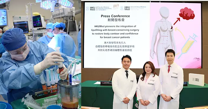 港大引入自體脂肪移植術 助乳癌患者重塑乳房重拾自信