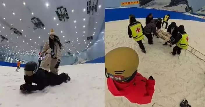 廣州女模仿日漫動作踩友人背上滑雪失重心跌落 雙腿扭成不自然角度骨折