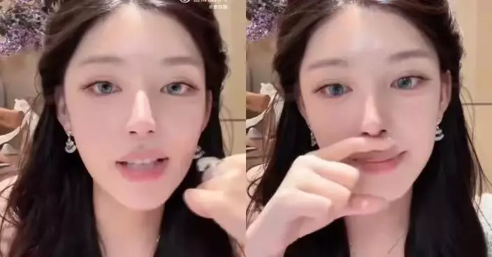 自爆隆鼻後遺症「無法擤鼻涕」 內地百萬網紅終決定取出多年假體