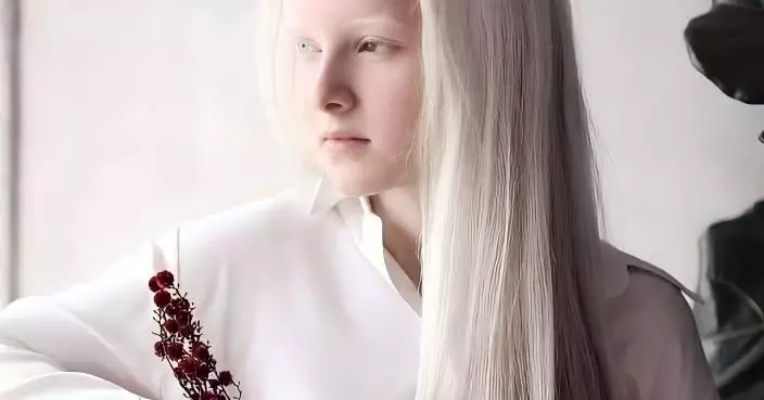 雪白髮色加異色雙瞳 車臣白化症少女仙氣照再爆紅 網民嘆：似童話走出嚟