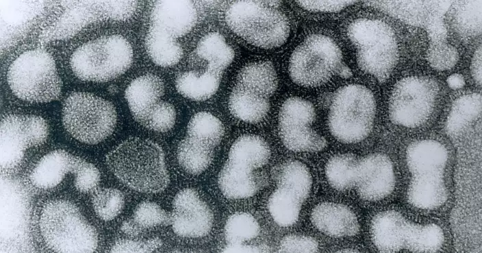 流感疫情持續升溫　日研究揭「這五類」人群感染風險最高！