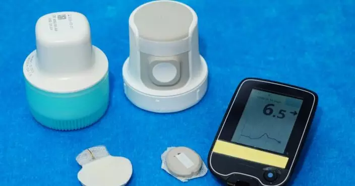 中大向年輕糖尿患者提供「連續血糖監測儀」代替「篤手指」驗血糖