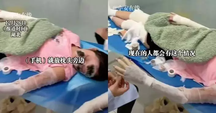 手機放枕邊充電突自燃爆炸 湖北女遭嚴重燒燙傷留大面積疤痕