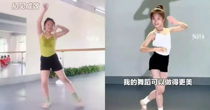 體型偏肥跳舞吃力 廣東女童為夢想戒高熱量飲食18個月成功甩13.5KG