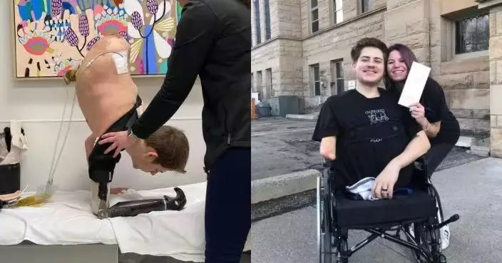 美漢遇嚴重工傷「下半身全切除」奇跡存活 卻遭部分家人視為「奇觀」感心寒