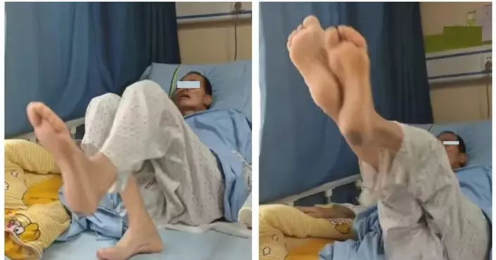 廣州6旬翁因意外「頭頸分離」命危送醫 獲多學科醫療團隊聯手搶救奇蹟保命