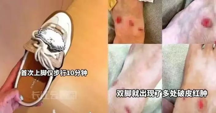 花逾萬買LV露後跟運動鞋 上海女著10分鐘磨破皮留疤需醫美 索償卻遭拒