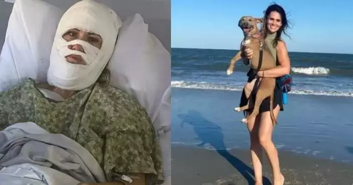 公園散步突遭陌生男潑腐蝕性化學液體 美國女近5成皮膚遭灼傷