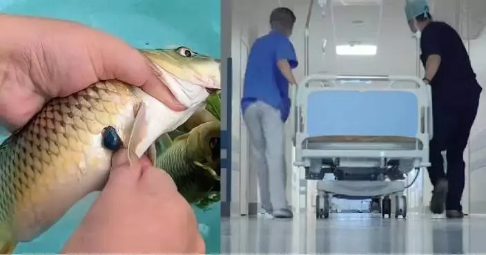 深圳女誤信偏方生吞草魚膽 數小時內急性肝衰竭險送命 醫揭：毒性堪比砒霜