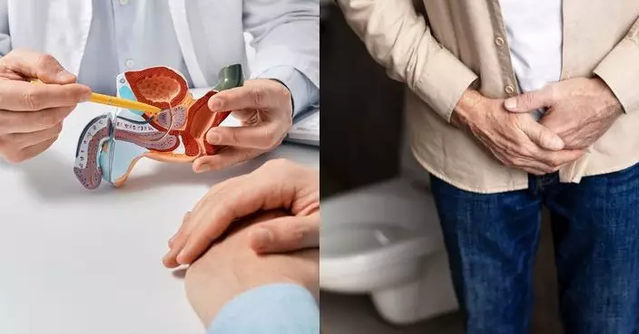 前列腺癌篩查與診斷方法詳解  PSA指數超標是否等同患癌？