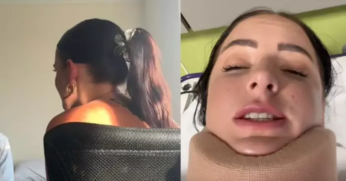 駕車遭追尾 澳洲女頭戴一物重擊腦部腦震盪扭頸 事後發文警示