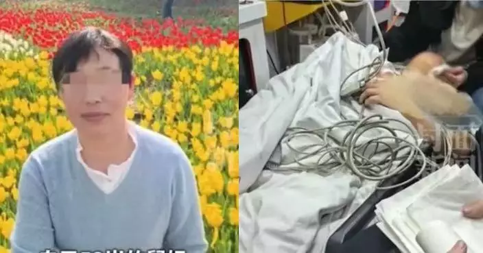 睇牙被一次性拔12顆牙 山西5旬婦術後下顎脫臼心梗休克入ICU