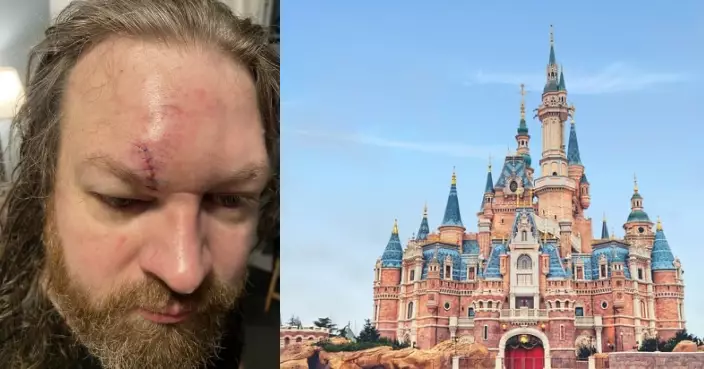 遊迪士尼勸阻打尖遭痛毆 美漢憂連累妻兒全程不敢還手面部爆血需縫針