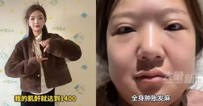 平日嗜辣！安徽女體重暴增近30kg以為單純發胖 就醫始揭患尿毒症