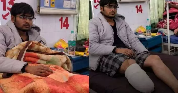 兩度考醫學院落榜 印度男恨當醫生竟自斬腳踝博殘疾名額入學震驚社會