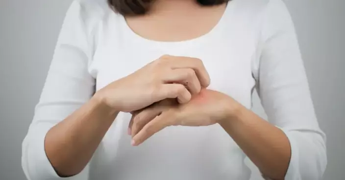 冬季皮膚痕癢多屬濕疹 專家指2常見習慣最傷皮膚 洗澡後3分鐘是保濕關鍵